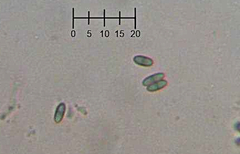Chaenothecopsis debilis