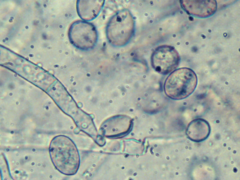 Botryobasidium conspersum