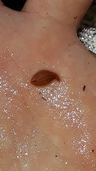 Helobdella