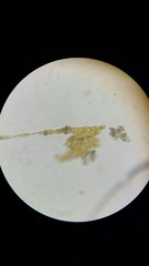 Bacillaria paxillifera