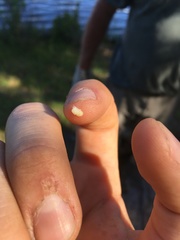 Amphibolips melanocera