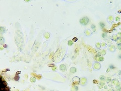 Sphaerellothecium coniodes