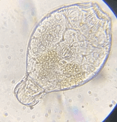 Philodina megalotrocha