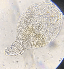 Philodina megalotrocha