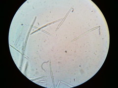 Puccinia liliacearum