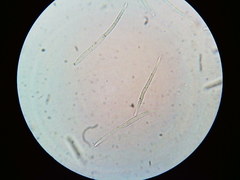 Puccinia liliacearum