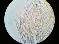 Puccinia liliacearum