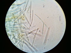 Puccinia liliacearum