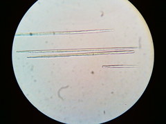 Puccinia liliacearum