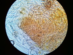 Puccinia liliacearum