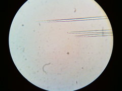 Puccinia liliacearum