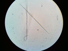 Puccinia liliacearum