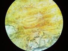 Puccinia liliacearum