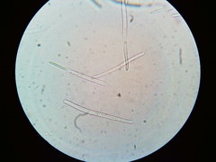 Puccinia liliacearum