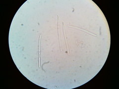 Puccinia liliacearum