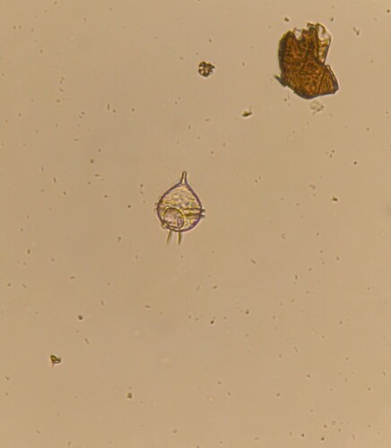Protoperidinium steinii