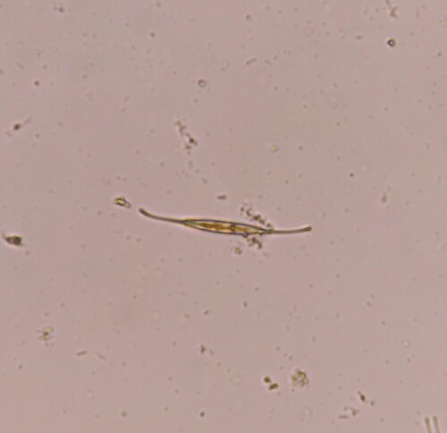 Nitzschia longissima