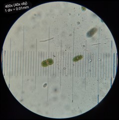 Actinotaenium curtum