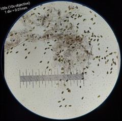 Actinotaenium curtum