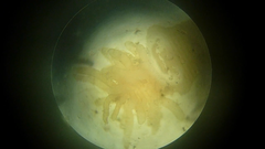 Priapulus caudatus