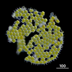 Pseudopediastrum boryanum