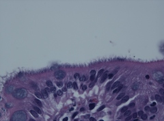 Brachyspira