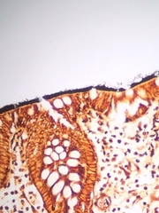 Brachyspira