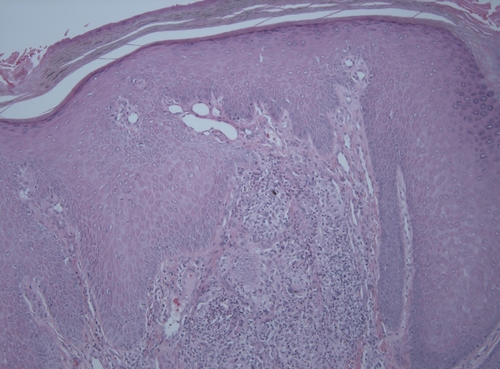 Fonsecaea pedrosoi · iNaturalist Mexico