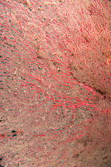 Melithaea