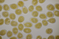 Pucciniastrum symphyti