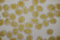 Pucciniastrum symphyti