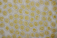 Pucciniastrum guttatum