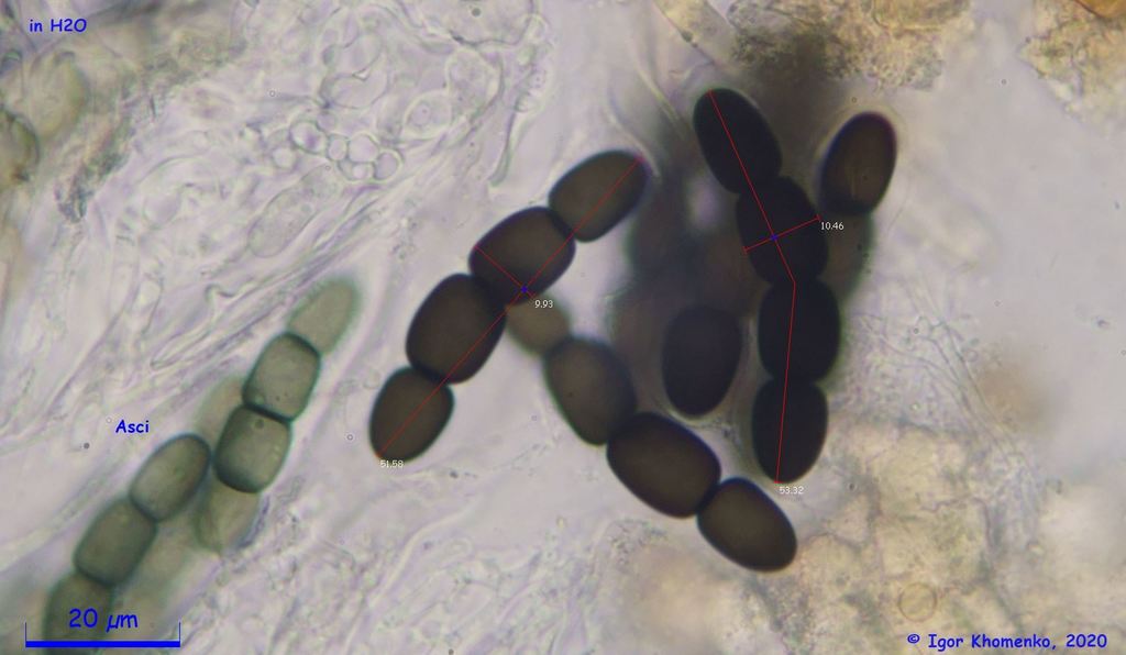 Sporormiella intermedia