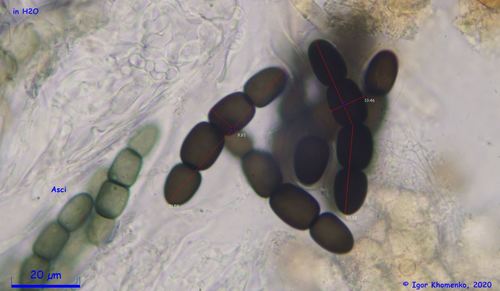 Representative image of Sporormiella intermedia