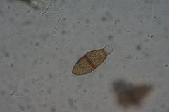 Puccinia liliacearum