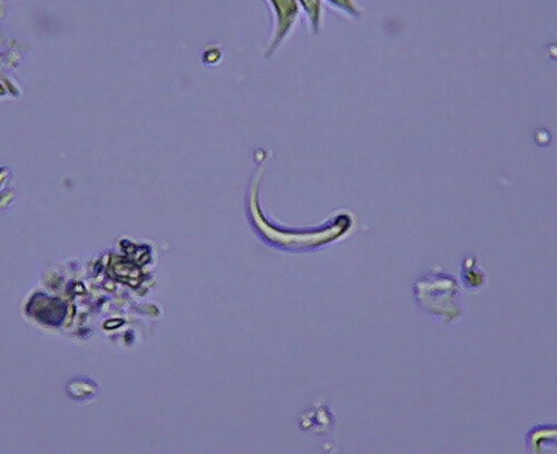 iNaturalist observation photo of Monoraphidium contortum