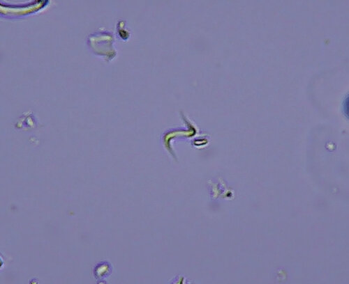 iNaturalist observation photo of Monoraphidium contortum