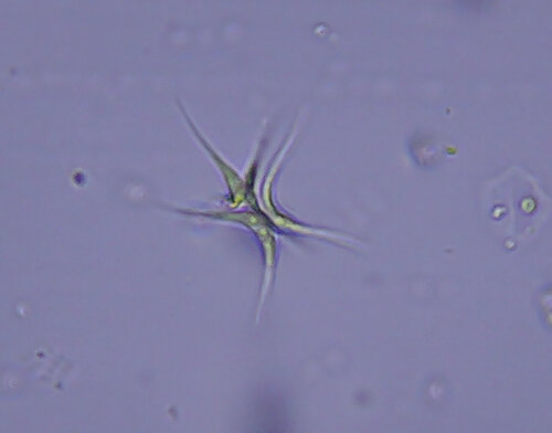 iNaturalist observation photo of green algae