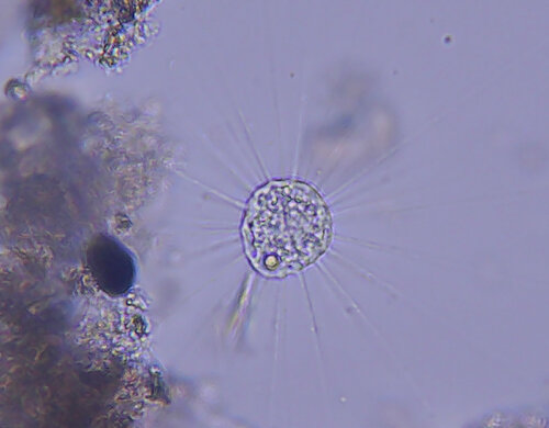 iNaturalist observation photo of Actinophrys sol