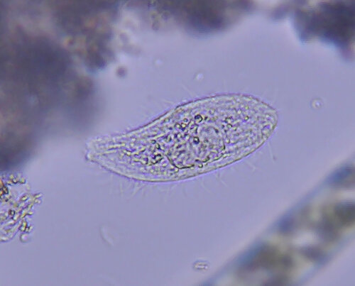 iNaturalist observation photo of Ciliates