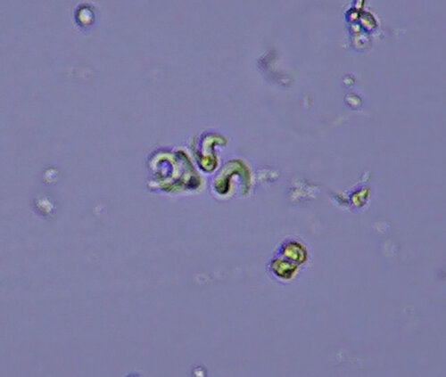 iNaturalist observation photo of green algae
