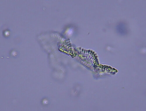 iNaturalist observation photo of cyanobacteria