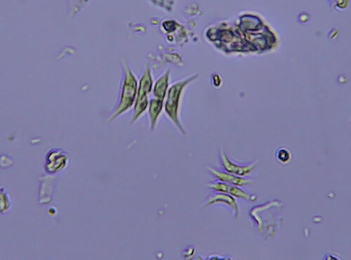 iNaturalist observation photo of Tetradesmus lagerheimii