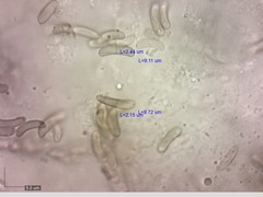 Eutypella cerviculata