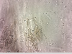 Eutypella cerviculata