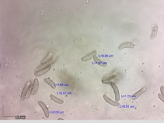 Eutypella cerviculata