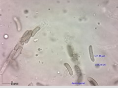 Eutypella cerviculata