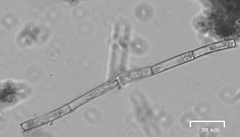 Charophyta