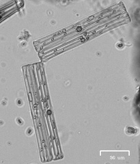 Fragilaria