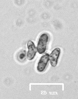 Charophyta